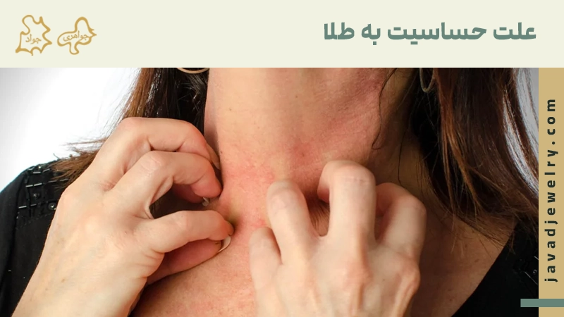 حساسیت به طلا چیست؟ علت حساسیت به طلا