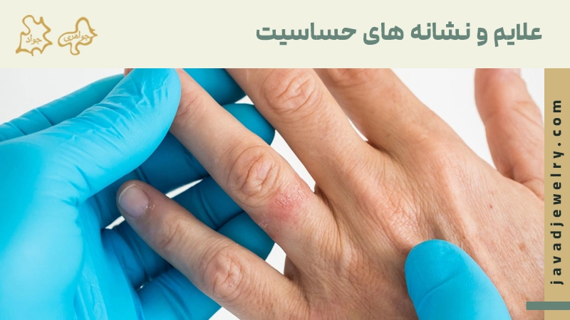 حساسیت به طلا چیست؟ علائم و نشانه های حساسیت